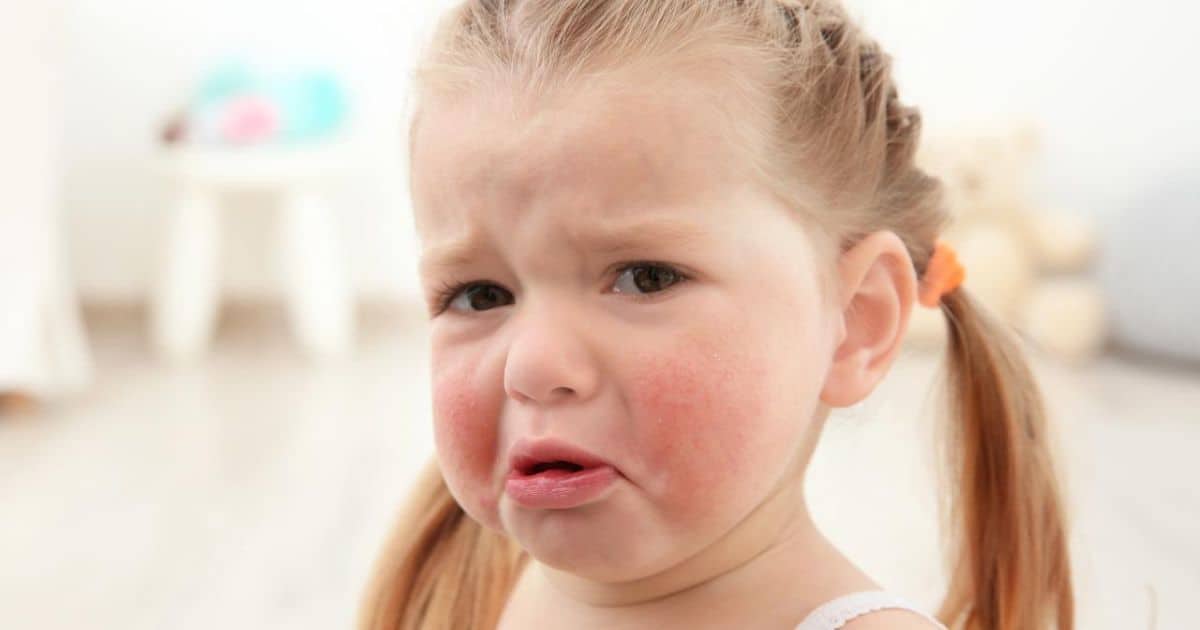 food-intolerance-babies